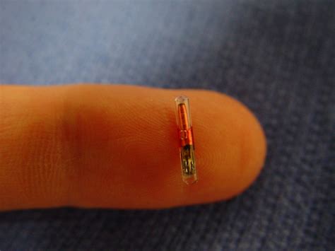 rfid chip adopted|chip implanted in the hand.